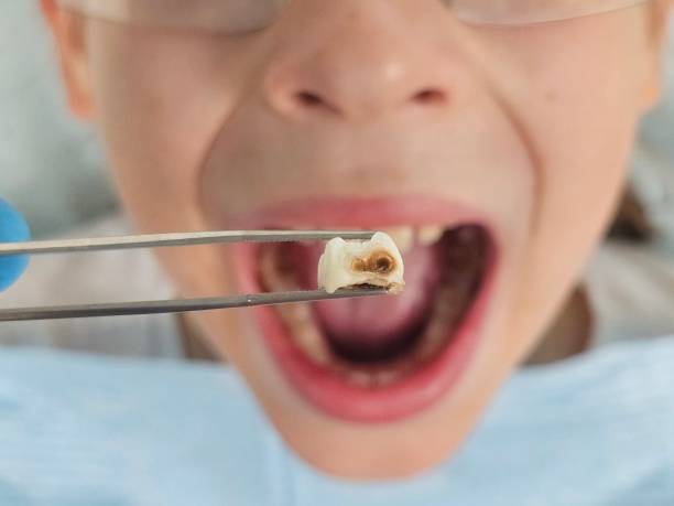 Best Emergency Pediatric Dental Care in Mabscott, WV